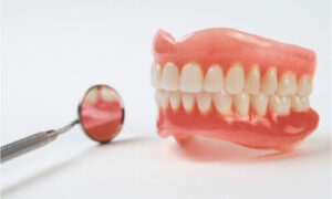 Example of full dentures.