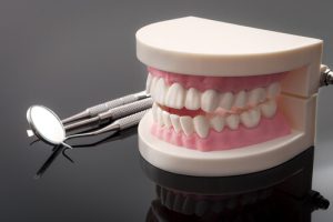 lower jaw tooth loss